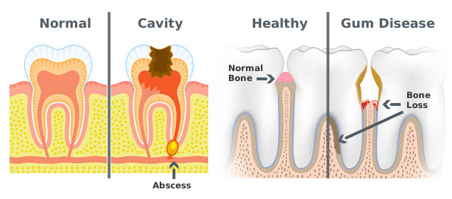 teeth